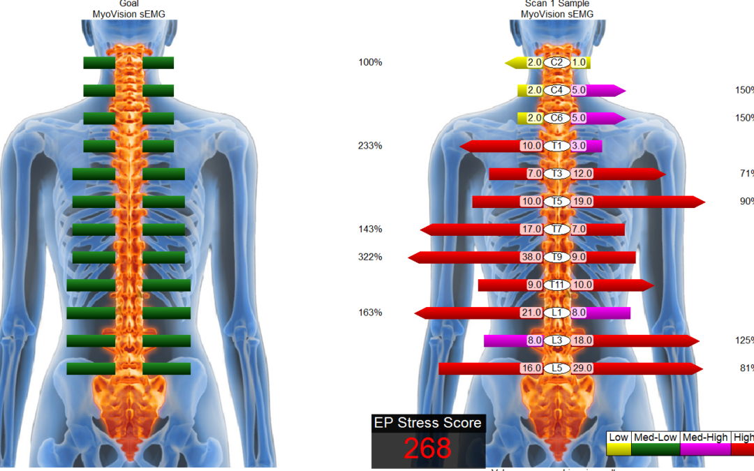 Do You Need X-rays Before Seeing a Chiropractor?